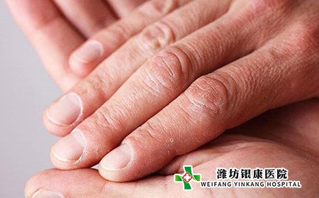 牛皮癬中醫(yī)病理是什么?初期癥狀表現(xiàn)?