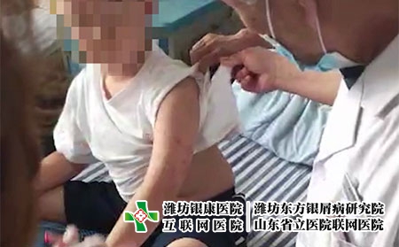 山東濰坊銀屑病醫院地址電話-濰坊銀屑病那里好