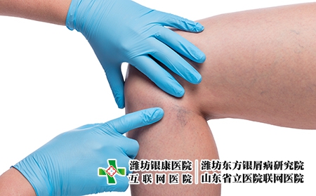 攝圖網_303522806_醫生親手檢查女腿和緊閉的容器上變血管（企業商用）關節