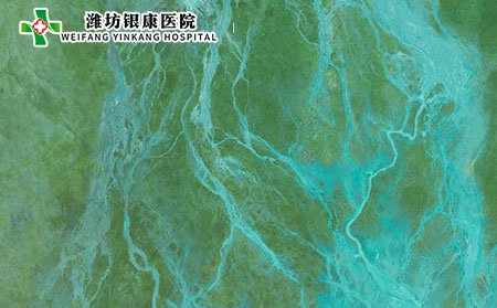 小兒過(guò)敏性紫癜的發(fā)病因素有哪些?可以吃紫薯嗎?